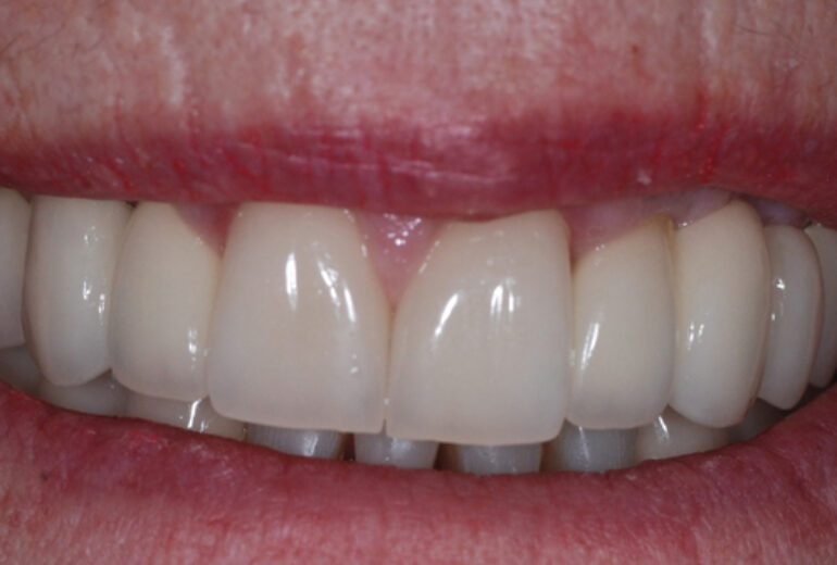 After - Dorset Dental