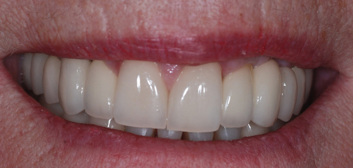 After - Dorset Dental