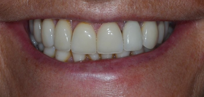 After - Dorset Dental