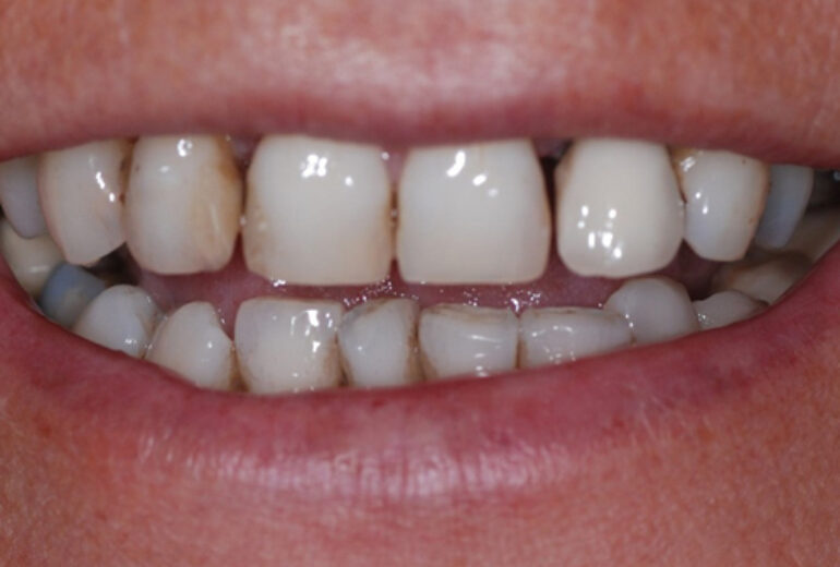 Before - Dorset Dental