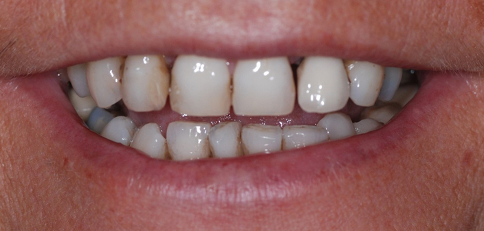 Before - Dorset Dental
