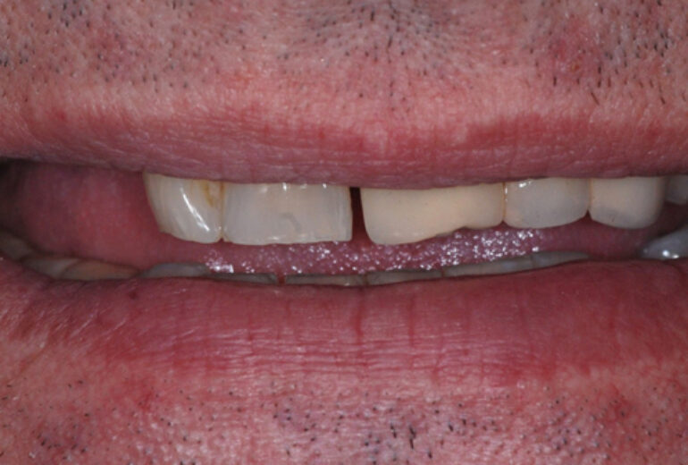 Before - Dorset Dental