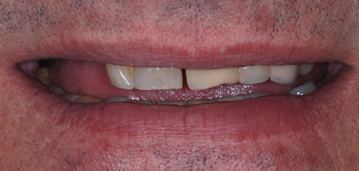 Before - Dorset Dental