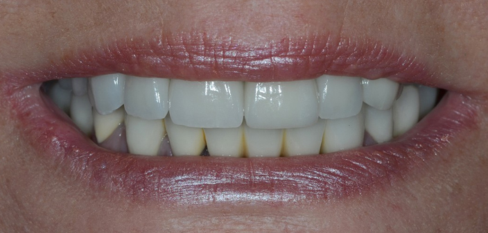 After - Dorset Dental