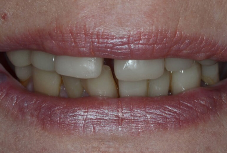 Before - Dorset Dental