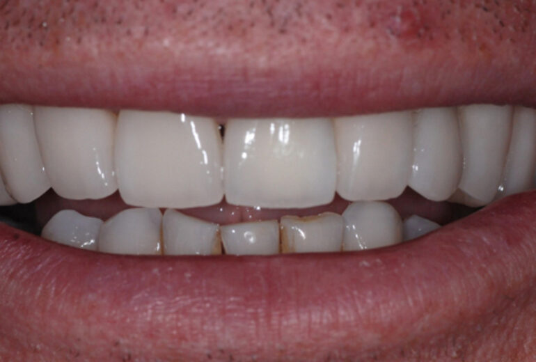 After - Dorset Dental