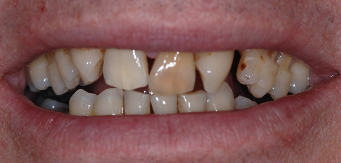Before - Dorset Dental