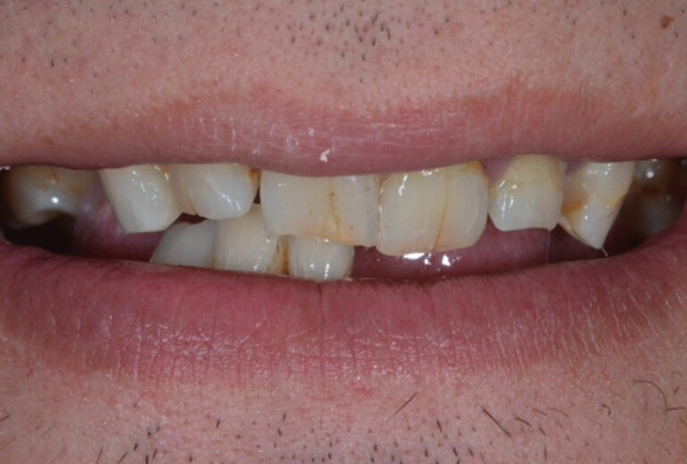 Before - Dorset Dental