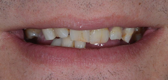 Before - Dorset Dental