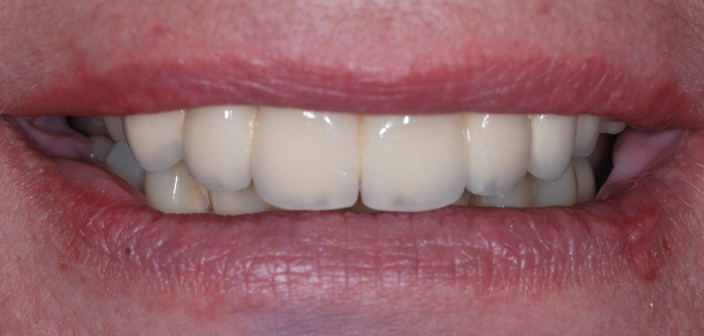 After - Dorset Dental