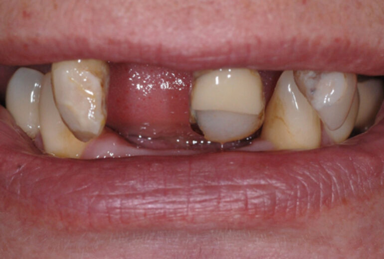 Before - Dorset Dental