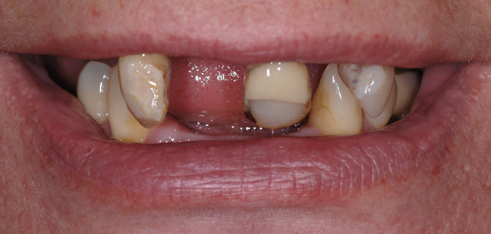 Before - Dorset Dental