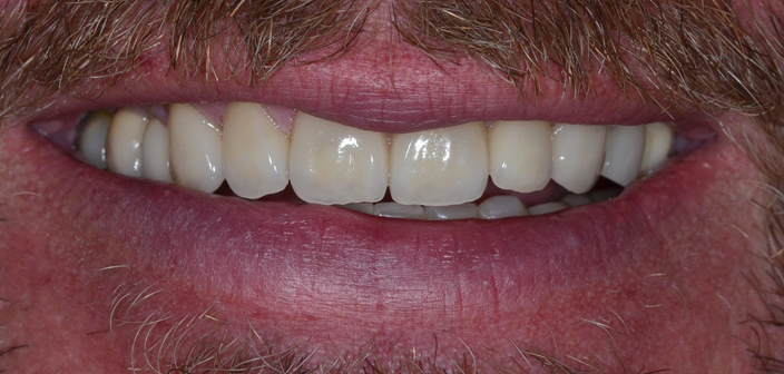 After - Dorset Dental