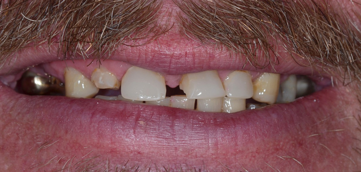 Before - Dorset Dental