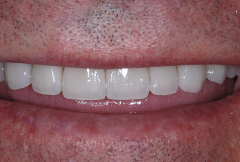 After - Dorset Dental