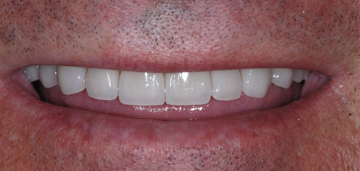 After - Dorset Dental