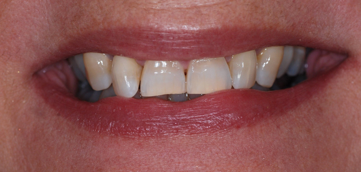 Before - Dorset Dental