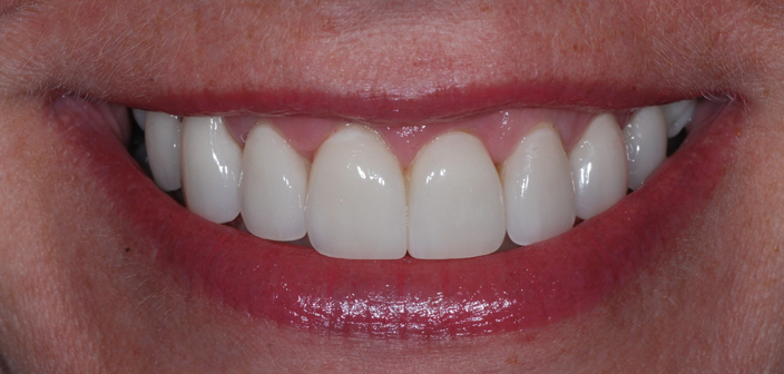 After - Dorset Dental