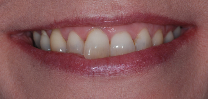 Before - Dorset Dental