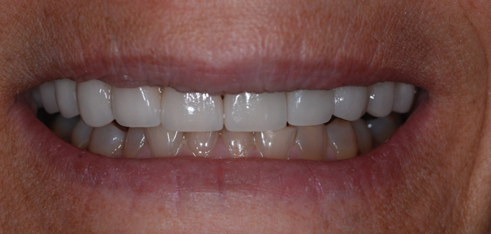 After - Dorset Dental