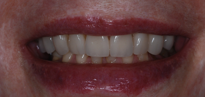 After - Dorset Dental