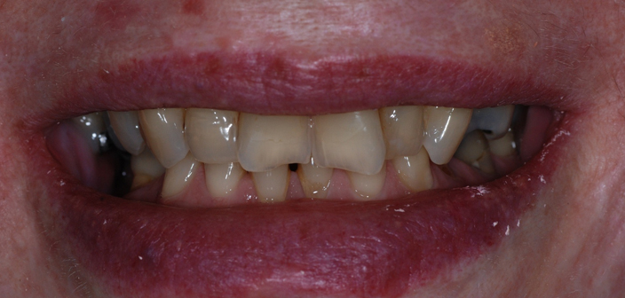 Before - Dorset Dental