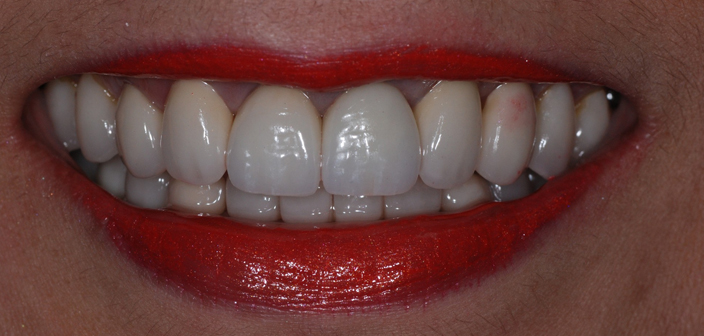 After - Dorset Dental