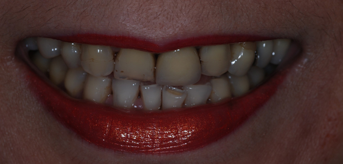 Before - Dorset Dental