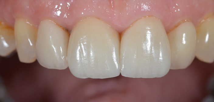 After - Dorset Dental