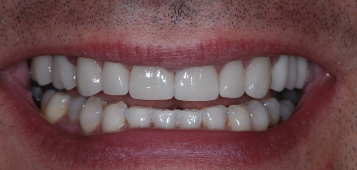 After - Dorset Dental