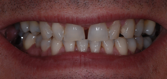 Before - Dorset Dental