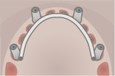 Dental Weld Case Image