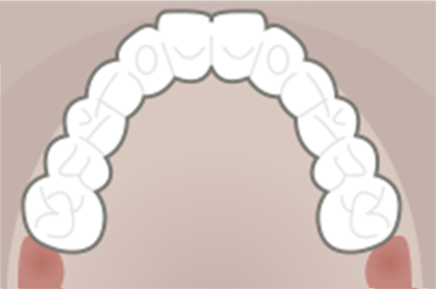 Dental Weld Case Image